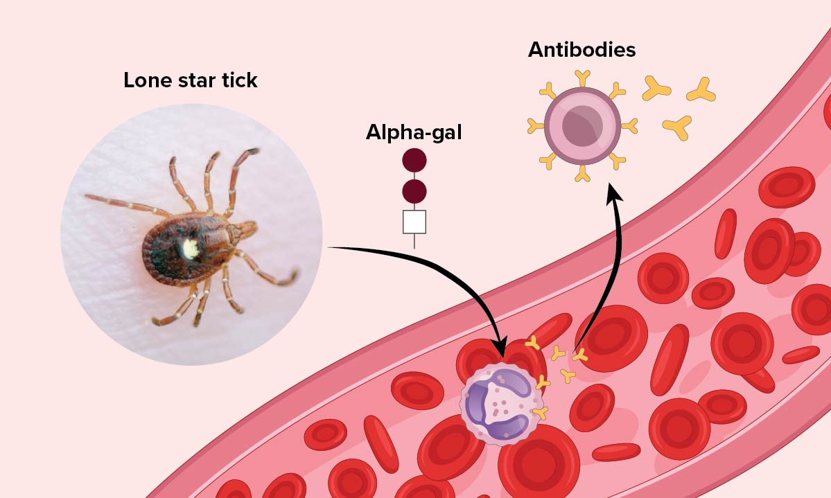 Illustration of Lone star tick surrounded by antibodies in the bloodstream.
